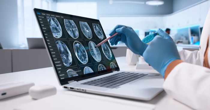 Female Neuro Radiology Technician Diagnosing Brain Injury In Medical